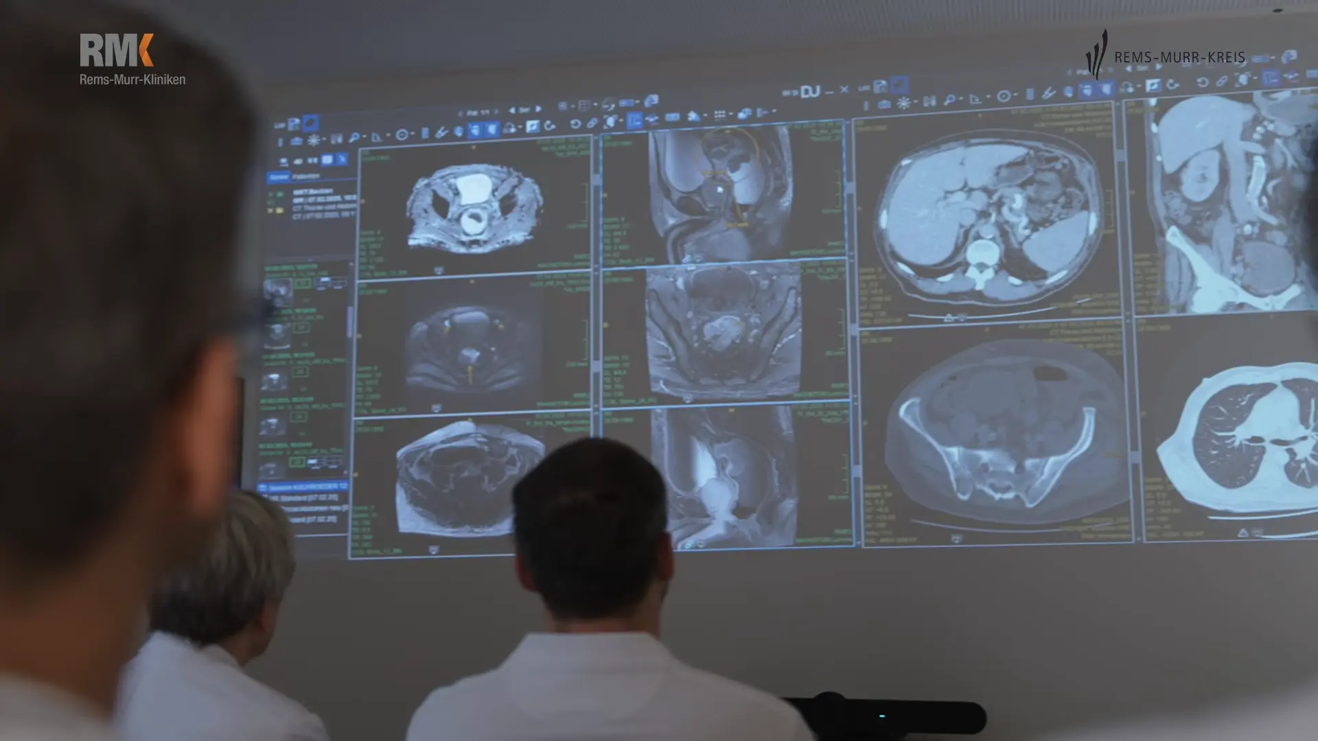 Tumorkonferenz zum Thema Darmkrebs - zertifiziertes Darmkrebszentrum am Rems-Murr-Klinikum Winnenden